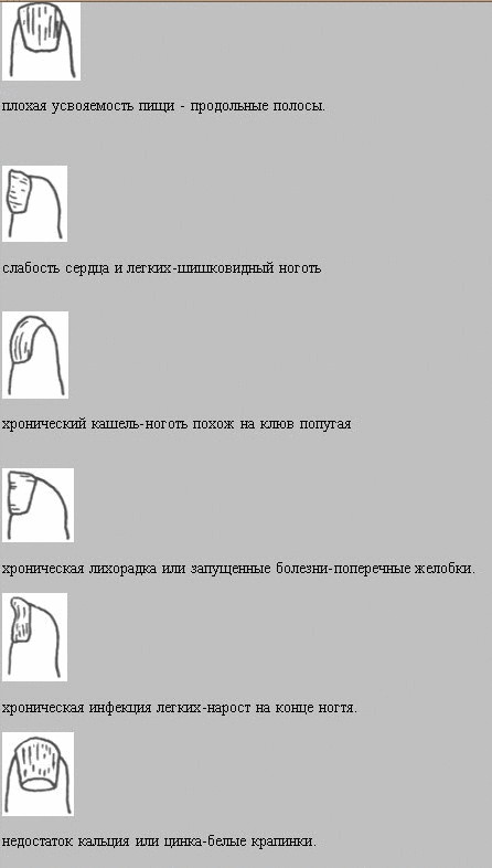 Восточная медицина: О каких болезнях можно узнать по ногтям